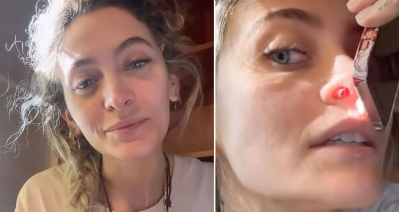 Ünlü şarkıcı burnundan gelen ‘ıslık sesinin’ sebebini açıkladı